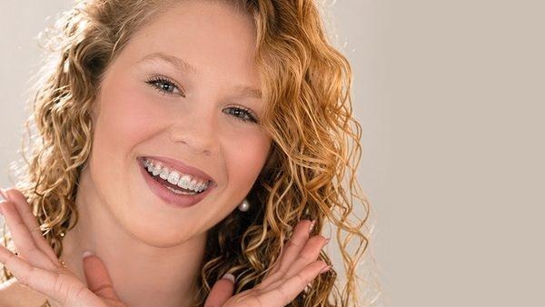 Smiling woman wearing CHARM braces