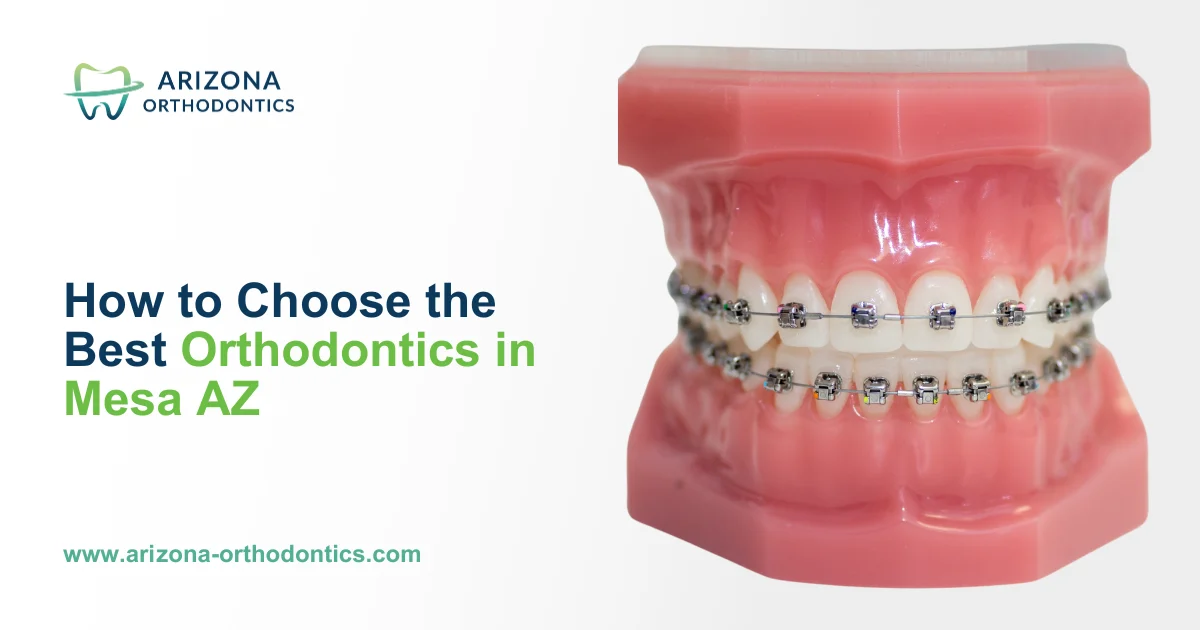How to Choose the Best Orthodontics in Mesa AZ