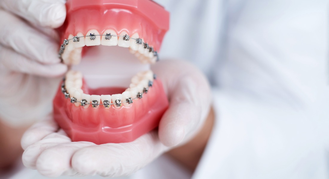 Orthodontic care